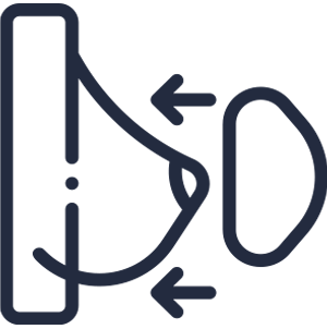 Mamoplastia De Aumento