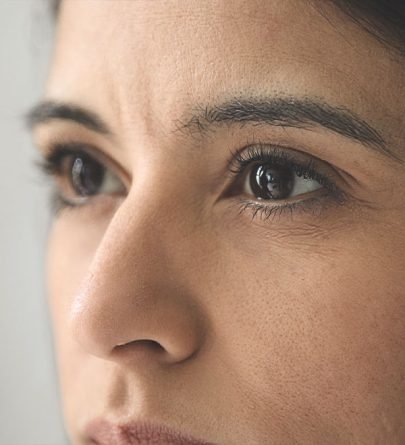 Blefaroplastia-Nos-Jardins-Dr-Alberto-Okada
