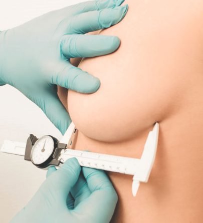 Mamoplastia-Redutora-Nos-Jardins-Dr-Alberto-Okada